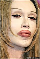 pete burns now